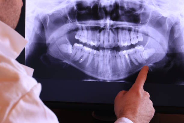 Best Emergency Treatment for Dental Infections or Abscesses in Helmetta, NJ