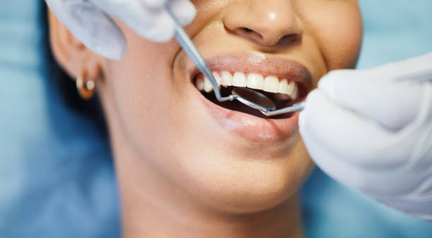 Best Urgent Care for Lost Fillings or Crowns in Helmetta, NJ